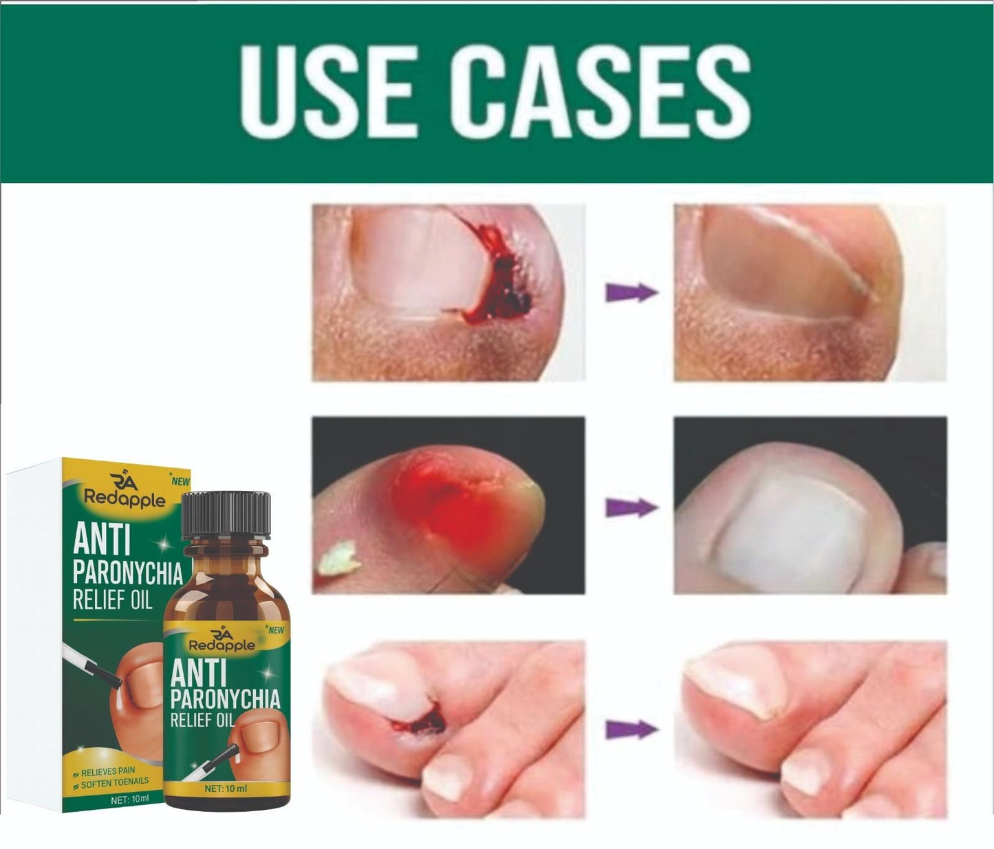NAIL GROWTH & CARE OIL