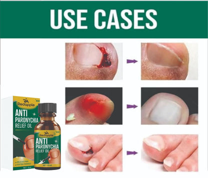 NAIL GROWTH & CARE OIL